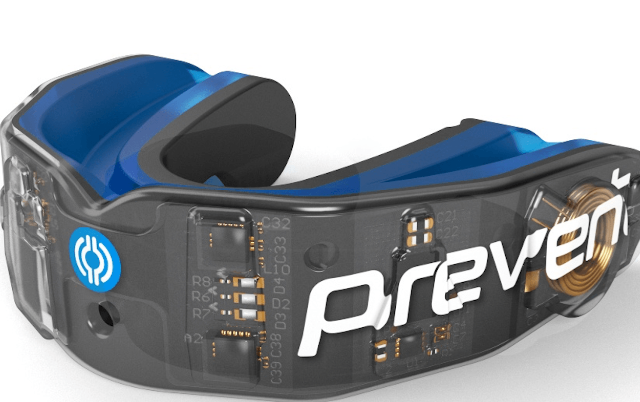 Smart mouthguards